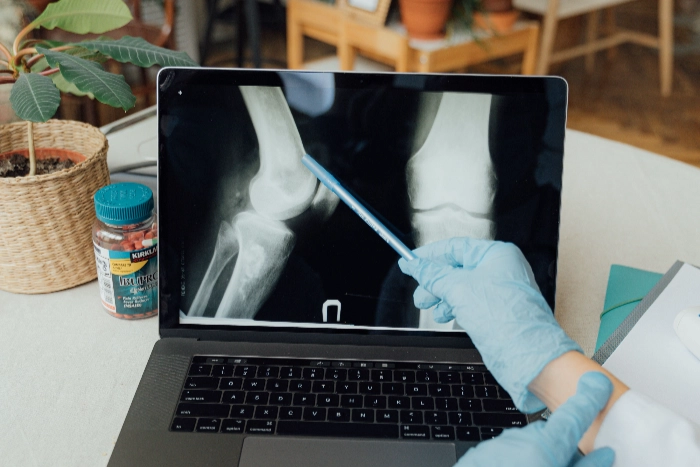 Arthritis Awareness CPD